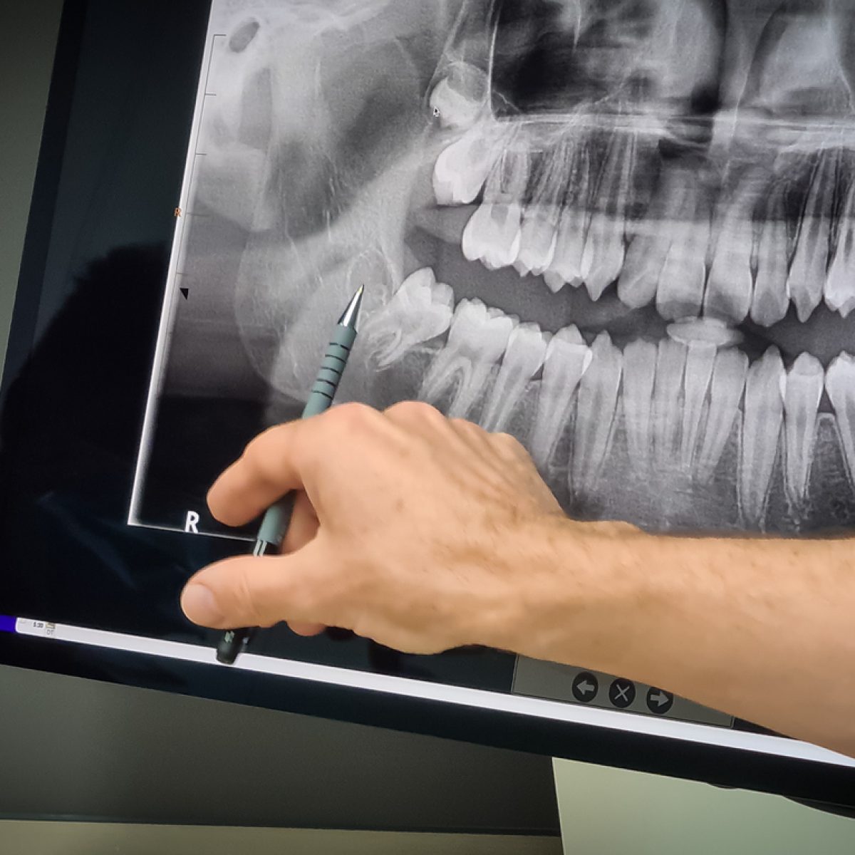 An orthodontist showing an X-ray of patient teeth.